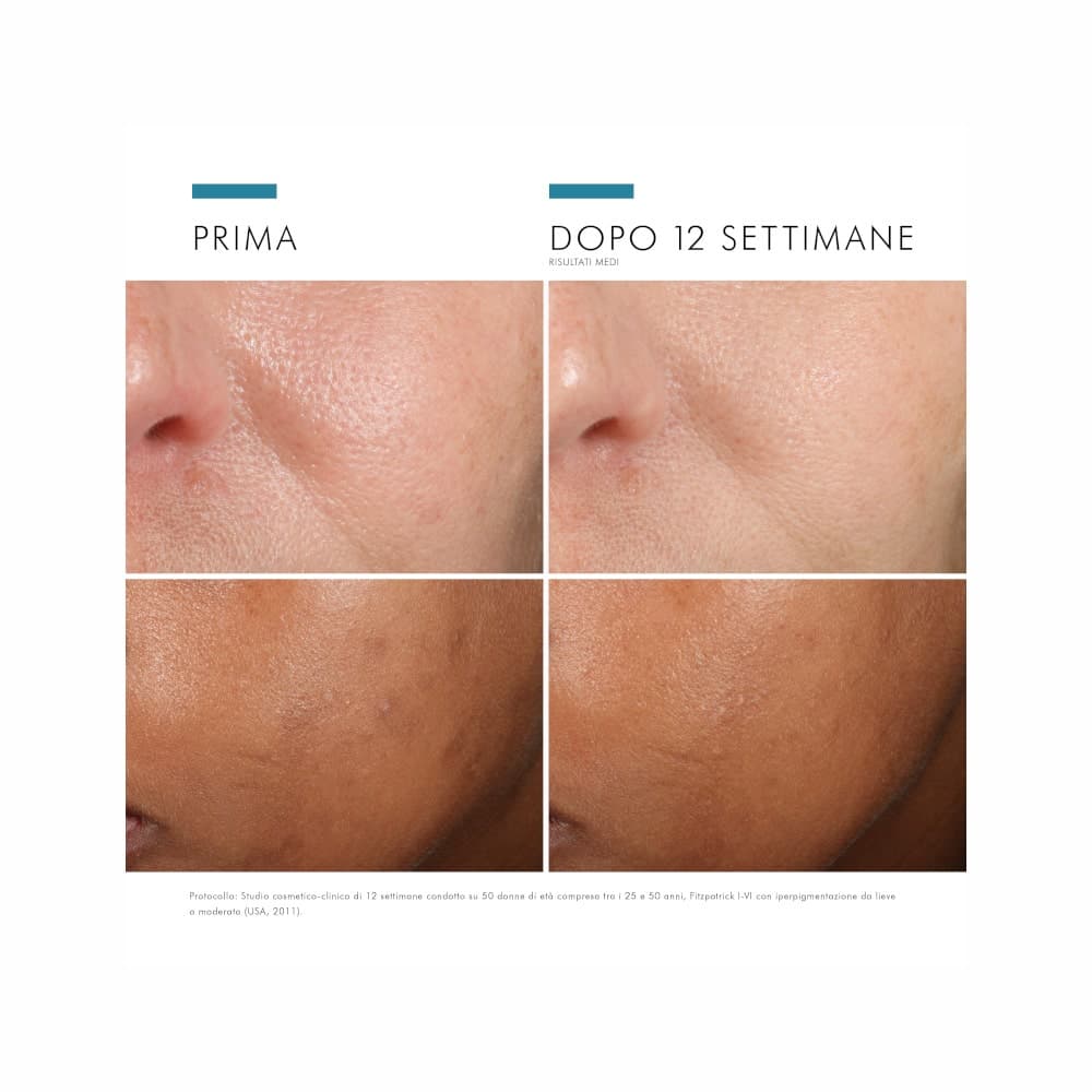 Phloretin CF Serum – 30 ml