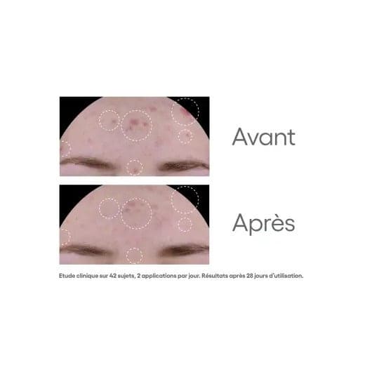A-Derma Biology AC Global Treatment